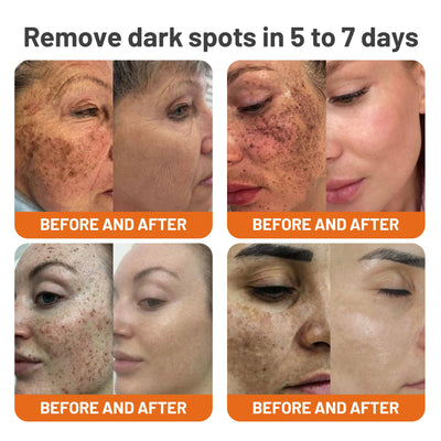 YouthRenew PM Mask – Wake Up to Radiant, Youthful Skin - 1+1 FREE