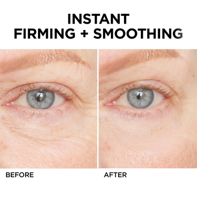 Ageless Aura Instant Lift + Erase Years in Seconds, Reveal a Timeless, Vibrant Gaze - 50% OFF