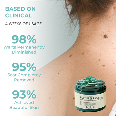 ClearGlow Instant Mole & Spot Removal Gel – Reveal Smooth, Radiant Skin Naturally - 50% OFF