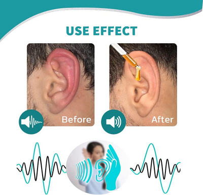SereneEar Elixir - Quiet the Noise, Soothe the Itch - 1+1 FREE