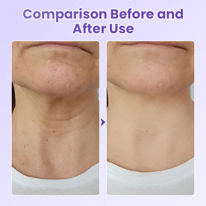 AuraLift Neck Patch - A Youthful, Sculpted Neck + 50% OFF