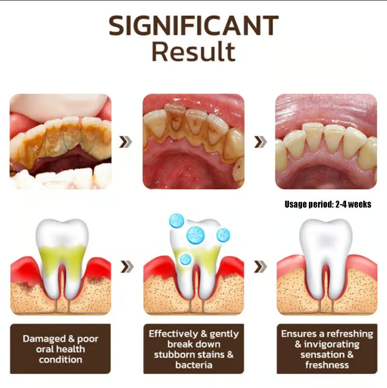 DentaBright Niacinamide Elixir - Reclaim Your Dazzling Smile & Unshakeable Confidence - 50% OFF