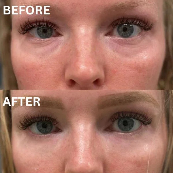 CryoGlow Patches - A Camera-Ready Look in 60 Minutes - 50% OFF