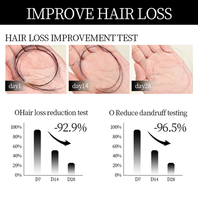 RootRenew Hair Activator Shampoo – Revive, Strengthen & Grow - 50% OFF