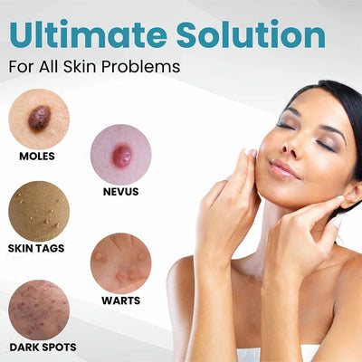 DermaZap - Flawless Skin, No Scars, No Surgery - 50% OFF