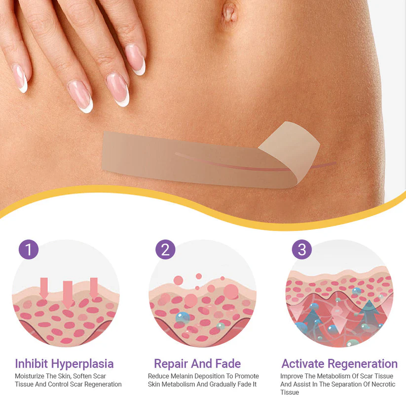 DermalCore Nano-Repair Tape - Erase Scars At The Root - 50% OFF