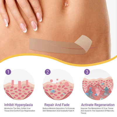DermalCore Nano-Repair Tape - Erase Scars At The Root - 50% OFF