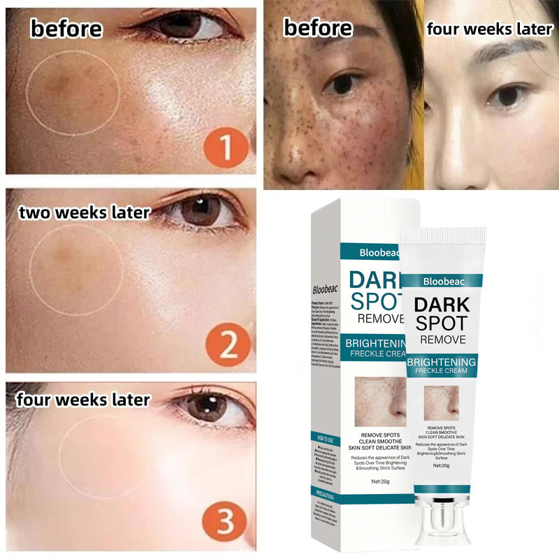 AuraRenew Blemish Cream - Erase Spots & Wrinkles - 50% OFF
