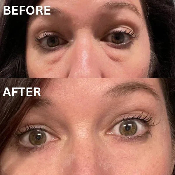 CryoGlow Patches - A Camera-Ready Look in 60 Minutes - 50% OFF