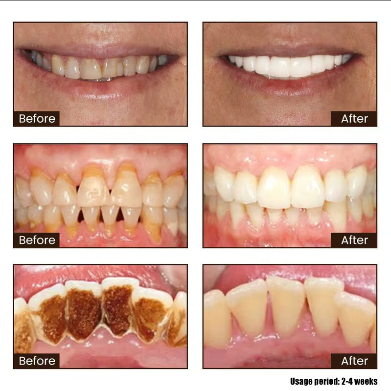 DentaBright Niacinamide Elixir - Reclaim Your Dazzling Smile & Unshakeable Confidence - 50% OFF