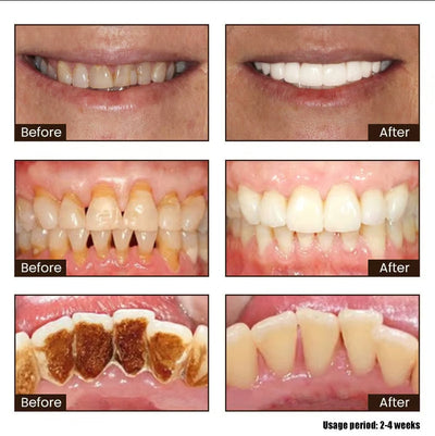 DentaBright Niacinamide Elixir - Reclaim Your Dazzling Smile & Unshakeable Confidence - 50% OFF