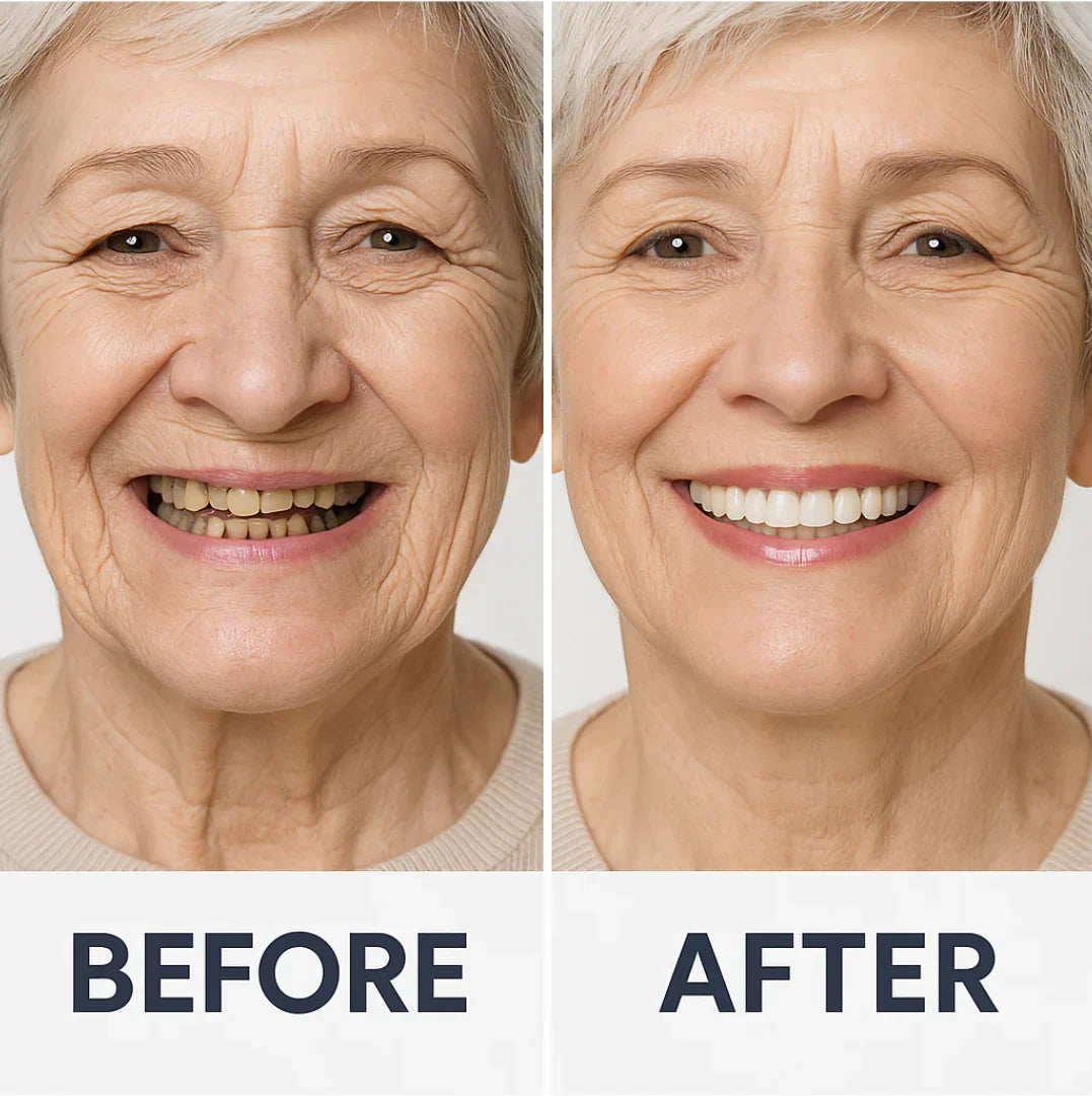 Comfort-Fit Flexible Dentures – Natural Look Easy Wear & Removal - 50% OFF