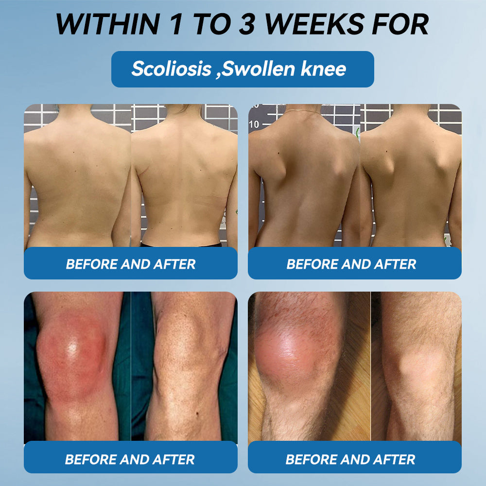 FlexaPeptide - Reclaim Your Mobility Fast + 50% OFF