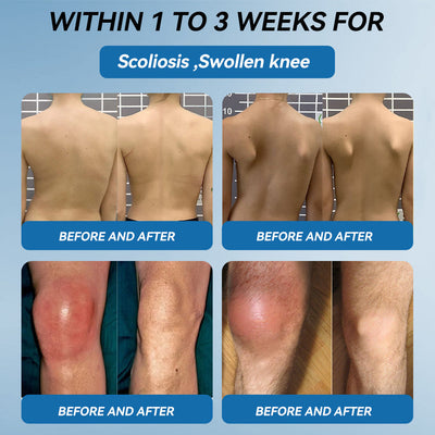 FlexaPeptide - Reclaim Your Mobility Fast + 50% OFF