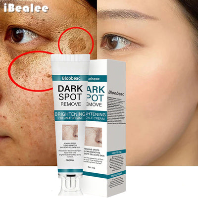 AuraRenew Blemish Cream - Erase Spots & Wrinkles - 50% OFF