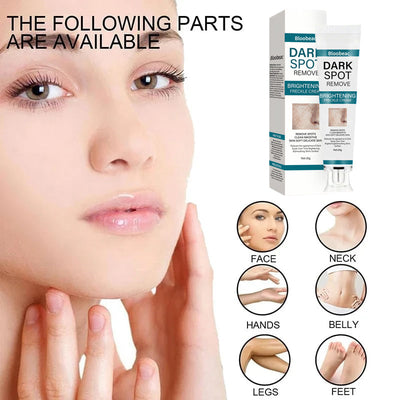 AuraRenew Blemish Cream - Erase Spots & Wrinkles - 50% OFF