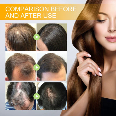 VoluBloom Hair Growth Serum – From Sparse to Strong, Naturally - 50% OFF