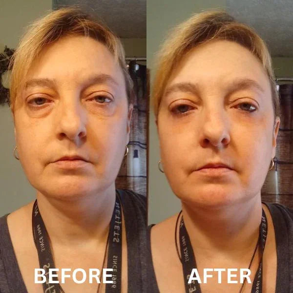 CryoGlow Patches - A Camera-Ready Look in 60 Minutes - 50% OFF