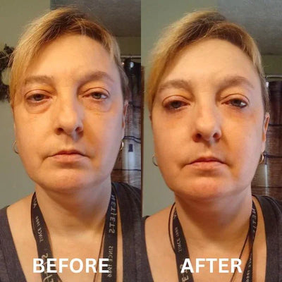 CryoGlow Patches - A Camera-Ready Look in 60 Minutes - 50% OFF