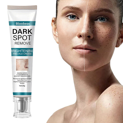 AuraRenew Blemish Cream - Erase Spots & Wrinkles - 50% OFF