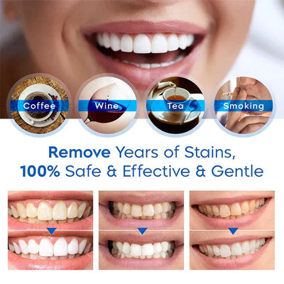 The Teeth Whitening Essence - A Whiter Smile, No Sensitivity + 50% OFF