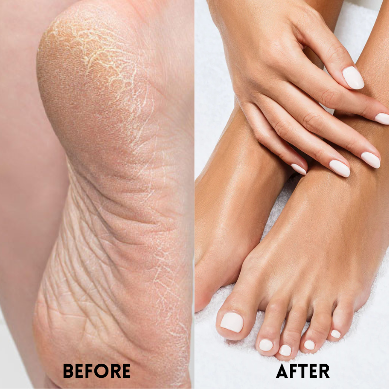 SilkyStep Foot Renewal Socks - Rejuvenate and pamper your feet with the ultimate spa experience - 1+2 FREE