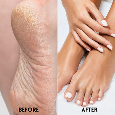 SilkyStep Foot Renewal Socks - Rejuvenate and pamper your feet with the ultimate spa experience - 1+2 FREE