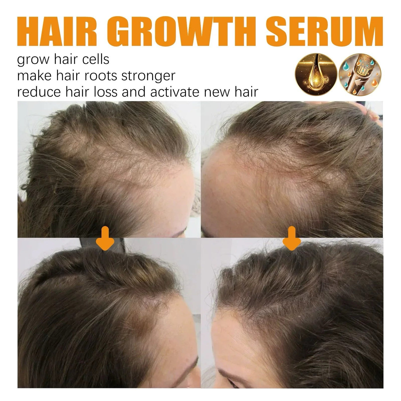 VoluBloom Hair Growth Serum – From Sparse to Strong, Naturally - 50% OFF