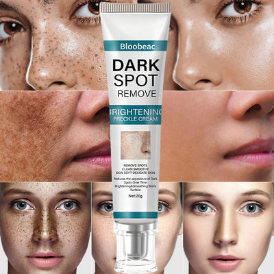 AuraRenew Blemish Cream - Erase Spots & Wrinkles - 50% OFF