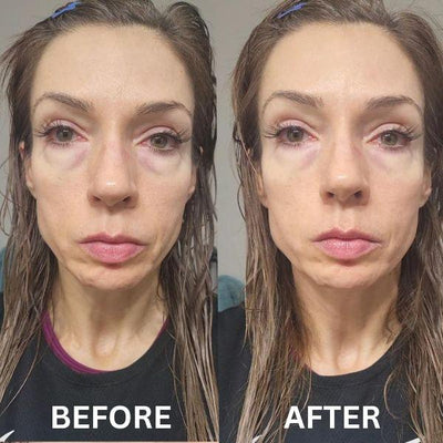 CryoGlow Patches - A Camera-Ready Look in 60 Minutes - 50% OFF