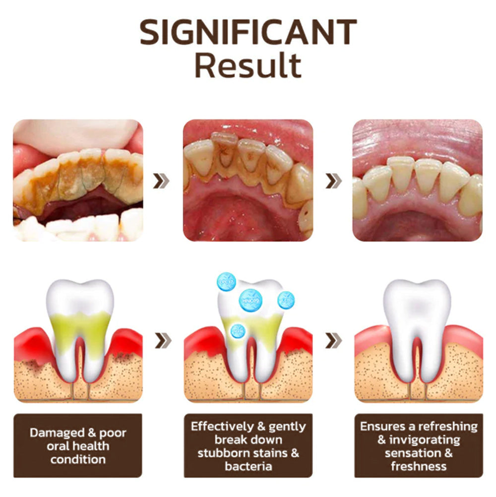 Pro-Denta Elixir - Restore Your Youthful Smile - BUY 1 GET 1 FREE