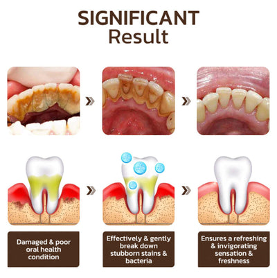 Pro-Denta Elixir - Restore Your Youthful Smile - BUY 1 GET 1 FREE