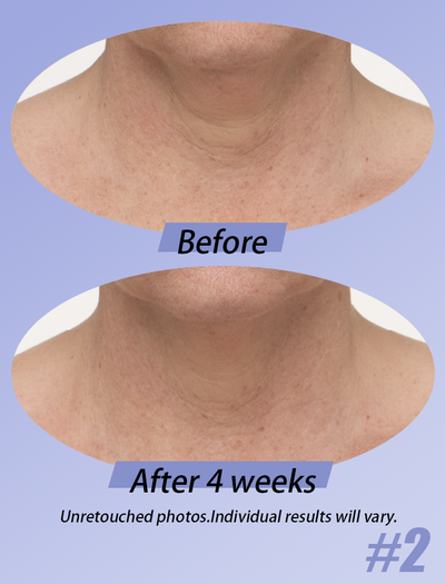 The DécolleFirm Cream - A Firmer, Younger-Looking Neck - 50% OFF