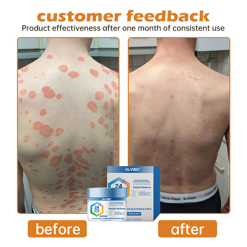 DermaNova DermaRenew – Your Path to Lasting Skin Health - 50% OFF