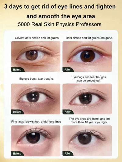 LumiBright Eye Cream - Erase Tired-Looking Eyes - 50% OFF