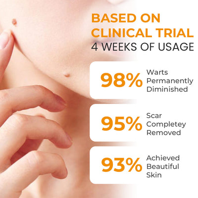 ClearSkin Erase Gel – Target Dark Spots, Moles & Blemishes with Precision - 50% OFF