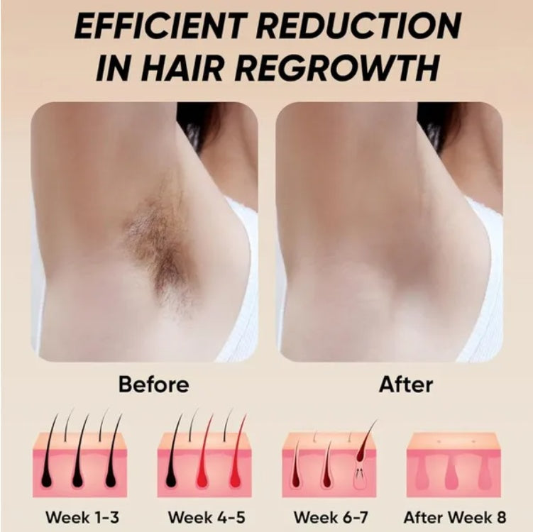 GlowBare IPL Hair Remover – Silky Skin Starts at Home - 50% OFF
