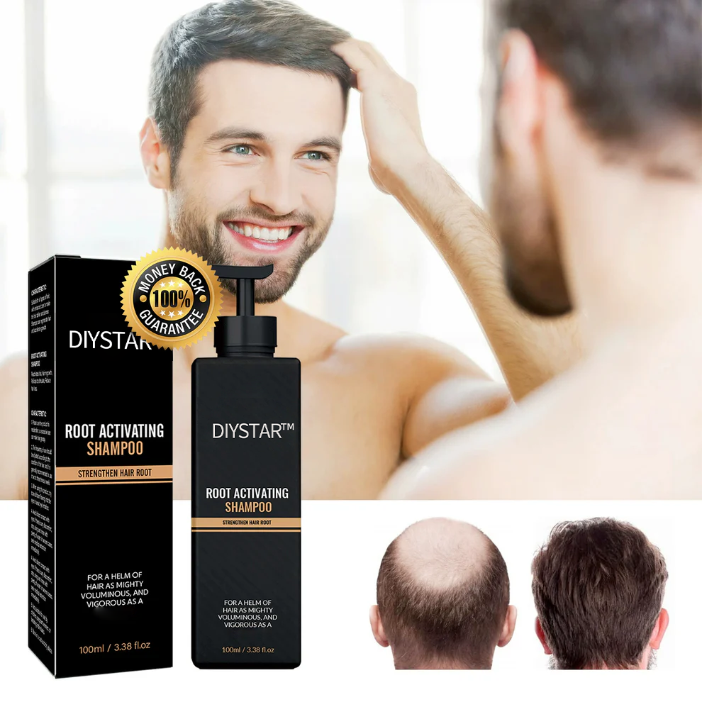 RootRenew Hair Activator Shampoo – Revive, Strengthen & Grow - 50% OFF