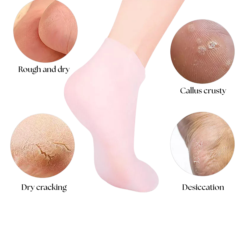 SilkyStep Foot Renewal Socks - Rejuvenate and pamper your feet with the ultimate spa experience - 1+2 FREE
