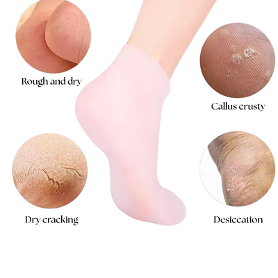 SilkyStep Foot Renewal Socks - Rejuvenate and pamper your feet with the ultimate spa experience - 1+2 FREE