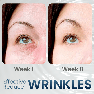 RadiantEyes Firming Eye Gel – Achieve Brighter, Firmer, Youthful-Looking Eyes - 1+1 FREE
