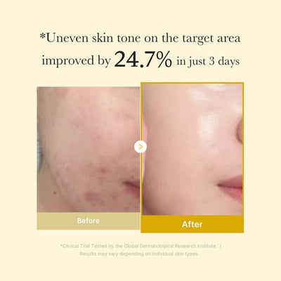 GlowRest Kojic Acid Turmeric Night Wrapping Mask – Wake Up to Radiant, Even-Toned Skin - 50% OFF