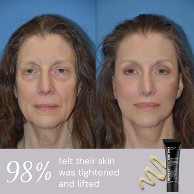 Ageless Aura Instant Lift + Erase Years in Seconds, Reveal a Timeless, Vibrant Gaze - 50% OFF
