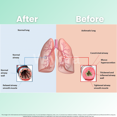 AirNova 2.0 - Breathe Easy, Anywhere + 50% OFF