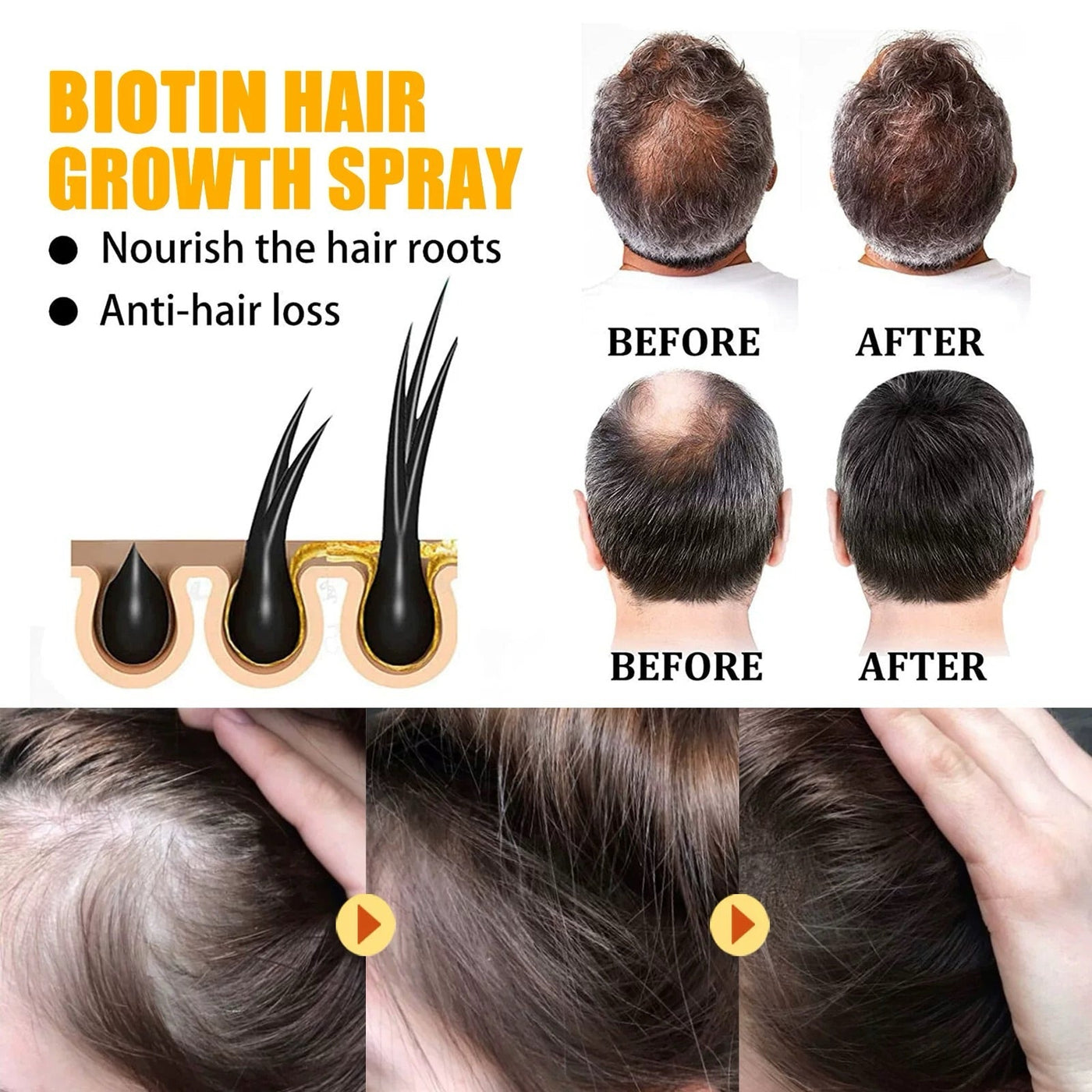 VoluBloom Hair Growth Serum – From Sparse to Strong, Naturally - 50% OFF