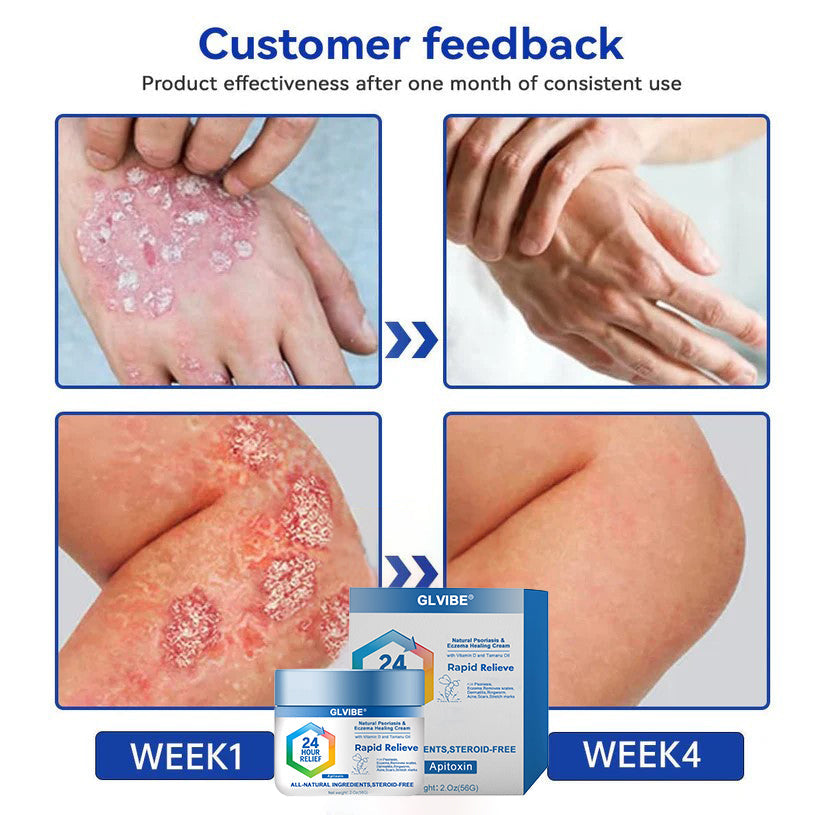 DermaNova DermaRenew – Your Path to Lasting Skin Health - 50% OFF