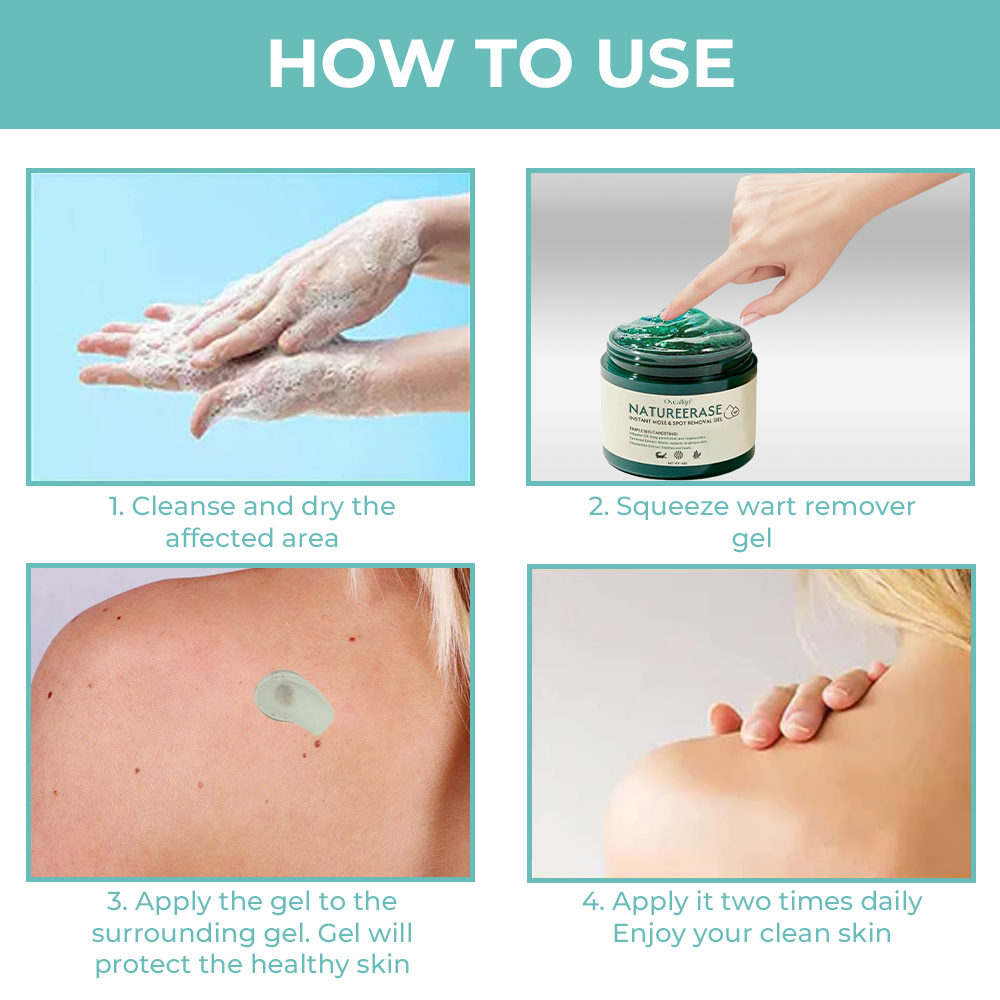 ClearGlow Instant Mole & Spot Removal Gel – Reveal Smooth, Radiant Skin Naturally - 50% OFF
