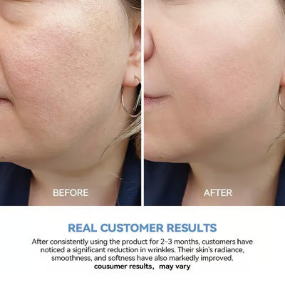 HydraGlass Ampoules - Ultra-Hydrating Vegan Serum - 50% OFF
