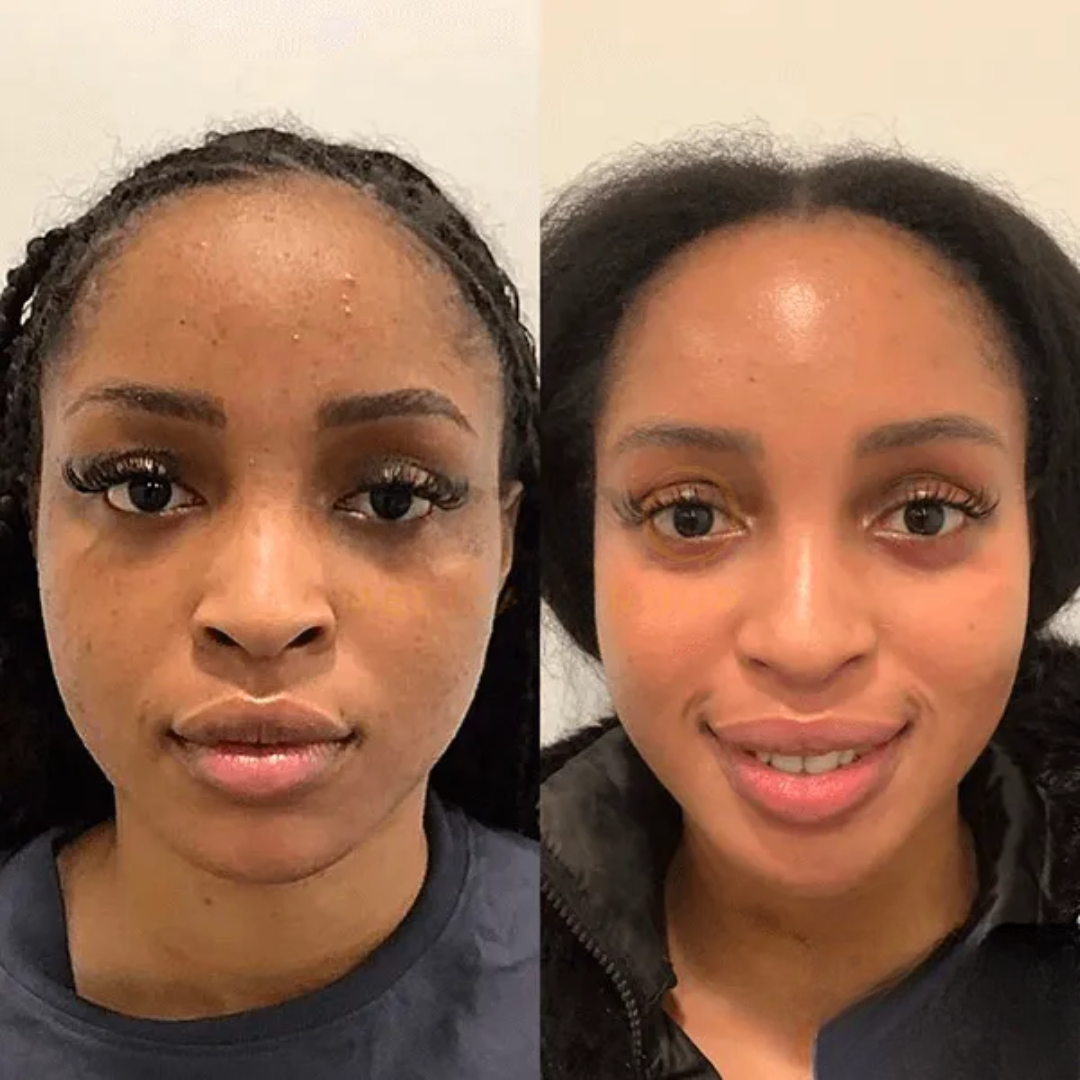 The CollagenWrap Night Mask - Wake Up to Plumper, Younger Skin + 50% OFF