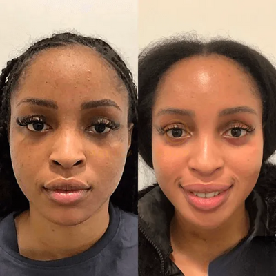 The CollagenWrap Night Mask - Wake Up to Plumper, Younger Skin + 50% OFF